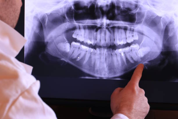 Best Emergency Tooth Extraction  in Richmond West, FL